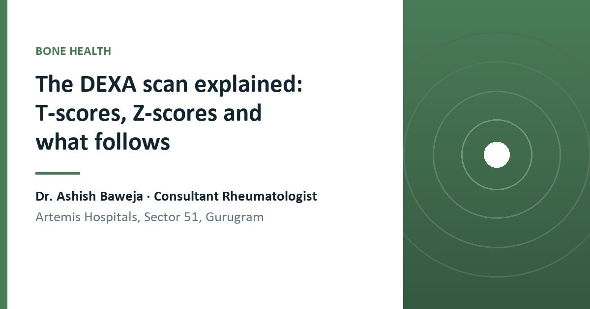 A T-score of -2.5 or lower defines osteoporosis, but the scan is only one input into fracture risk. How to read both scores and what happens after a low result.