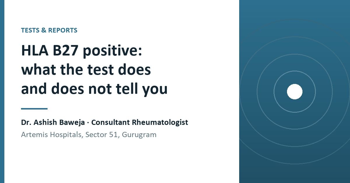 Carrying HLA-B27 is common and most carriers never fall ill. What the test measures, when it genuinely helps, and why the back pain pattern matters more.